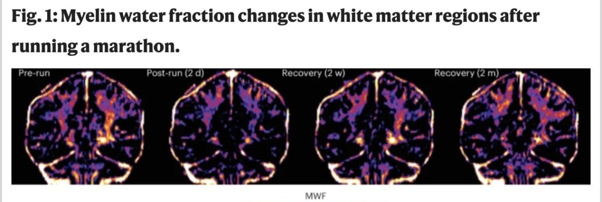“Apagão mental” após corridas longas tem origem no sistema nervoso central, apontam médico e estudo de 2024 - Imagem do artigo original