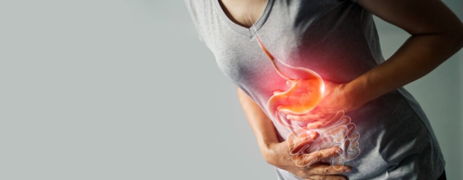 Má digestão: médico detalha sintomas, causas e caminhos para o tratamento - Imagem do artigo