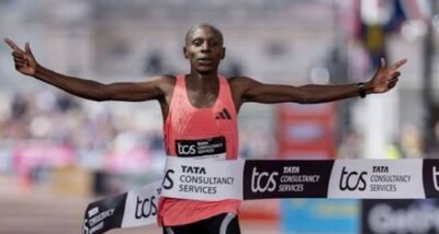 Hiperidrose afeta vida social, mas tratamento especializado oferece alívio - Imagem do artigo original